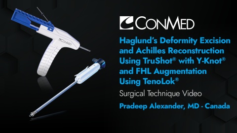 Haglund's Deformity Excision and Achilles Reconstruction Using TruShot® with Y-Knot® and FHL Augmentation Using TenoLok® - Pradeep Alexander, MD