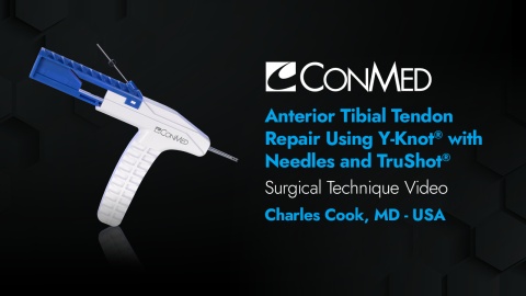 Anterior Tibial Tendon Repair Using Y-Knot® with Needles, TruShot® with Y-Knot®, and GENESYS Matryx® - Charles Cook, MD