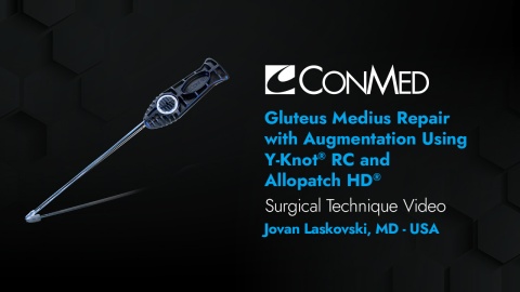 Dr. Laskovski - Endoscopic Gluteus Medius Repair with Augmentation Using Y-Knot® RC and Allopatch HD®