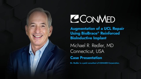 Dr. Redler Presentation (2025) - Augmentation of a UCL Repair Using BioBrace® Reinforced Biolnductive Implant