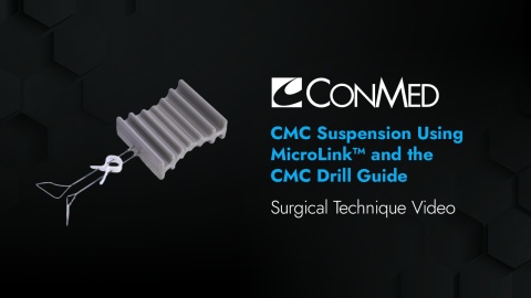 CMC Suspension Using MicroLink™ and the CMC Drill Guide