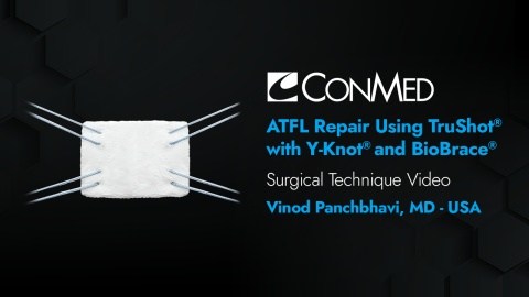 ATFL Repair Utilizing TruShot® with Y-Knot® and BioBrace® Implant - Vinod Panchbhavi, MD