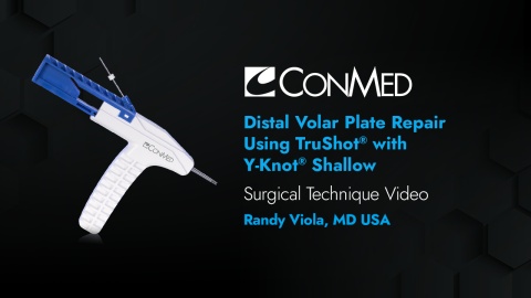 Dr. Viola - Distal Volar Plate Repair Using TruShot® with Y-Knot® Shallow