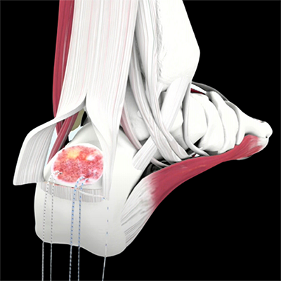 Orthopädie Extremitäten